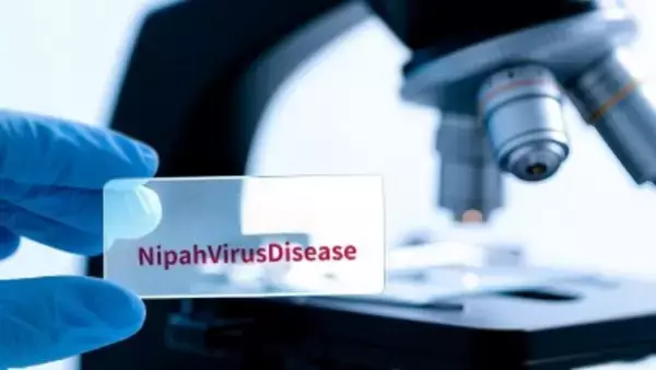 中国科学院武漢ウイルス研究所、ニパウイルスの有望な治療薬を発見