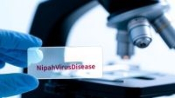 中国科学院武漢ウイルス研究所、ニパウイルスの有望な治療薬を発見