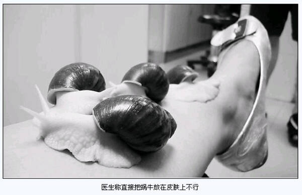 生きたカタツムリで カタツムリ美容パック したらカタツムリが死んだ 11年6月27日 エキサイトニュース