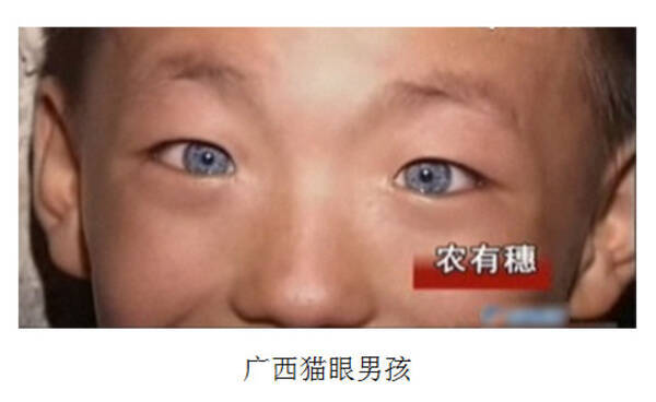 中国の青い猫目を持つ少年が話題に 12年2月2日 エキサイトニュース