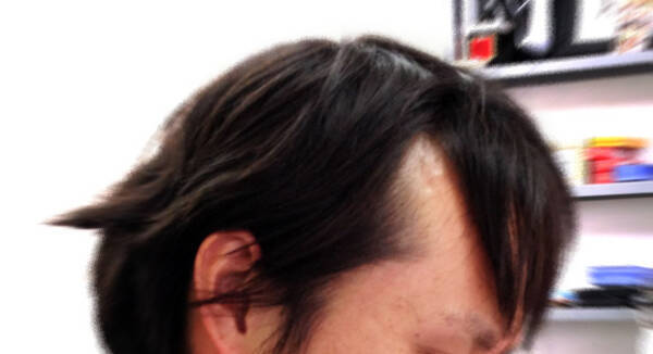 はやく 東京理科大が 髪の毛が生える器官 の再現に成功 抜け毛の根本的な治療法になるかも 12年4月18日 エキサイトニュース