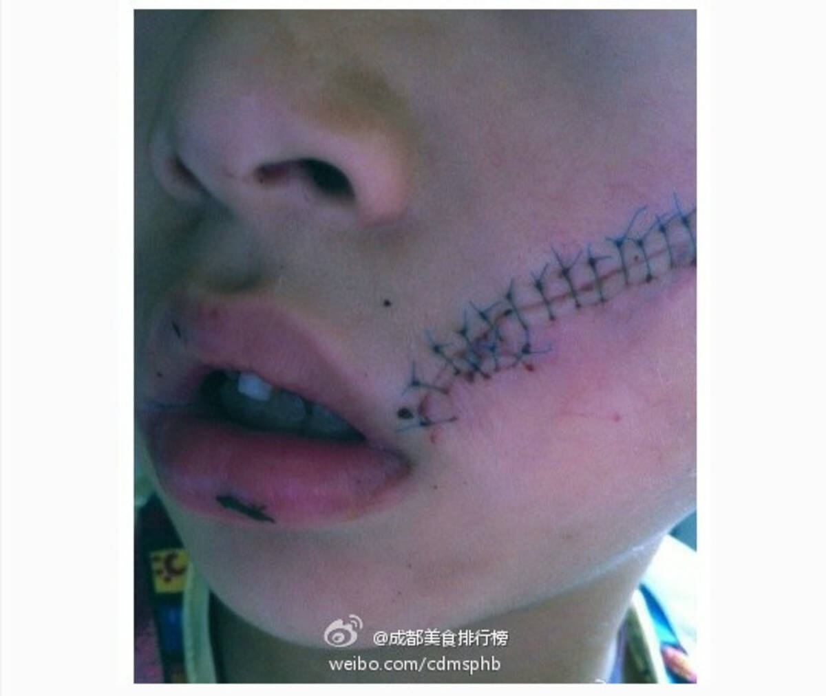 中国で冷凍コーラが爆発 12年8月28日 エキサイトニュース