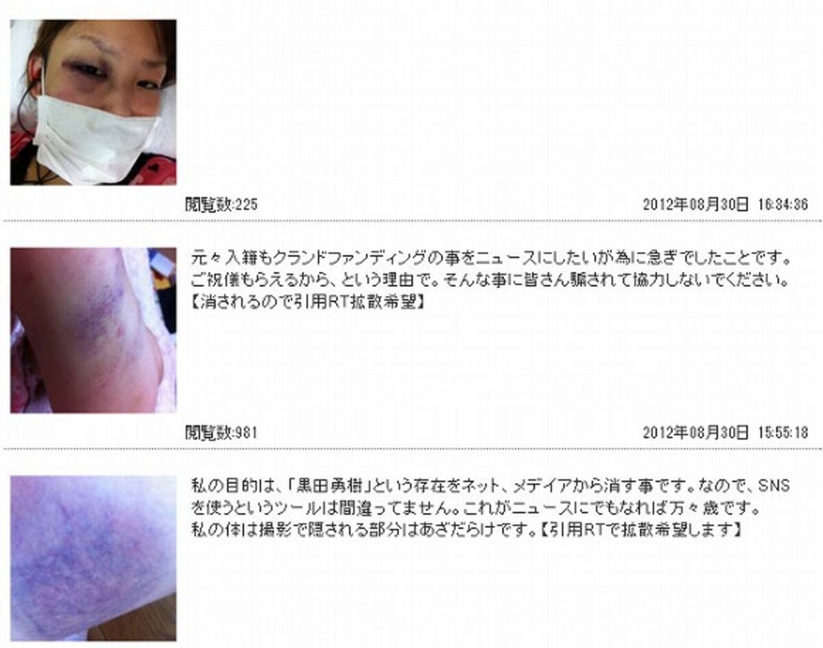 黒田勇樹が妻をワイン瓶で殴るなどの家庭内暴力か Twitterであざだらけの画像が公開される 12年8月30日 エキサイトニュース