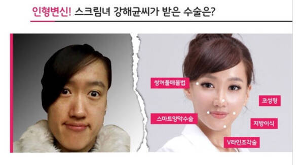 韓国 ウソップに似ていると言われた女性が整形で大変身 どう見ても別人に 13年1月9日 エキサイトニュース