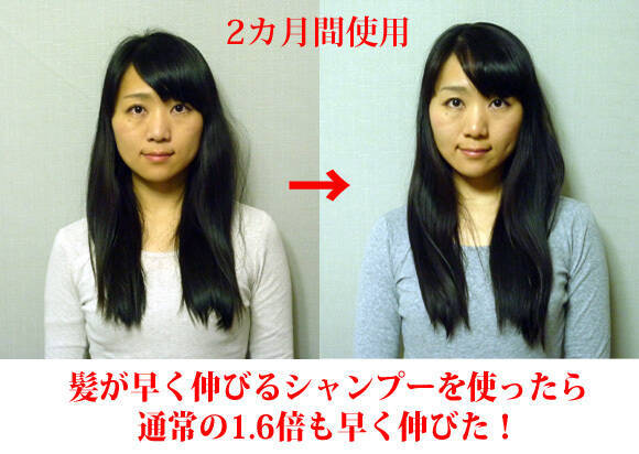 通常の1 6倍 髪が早く伸びるシャンプーを使ったら本当に早く伸びてビックリした 13年2月日 エキサイトニュース
