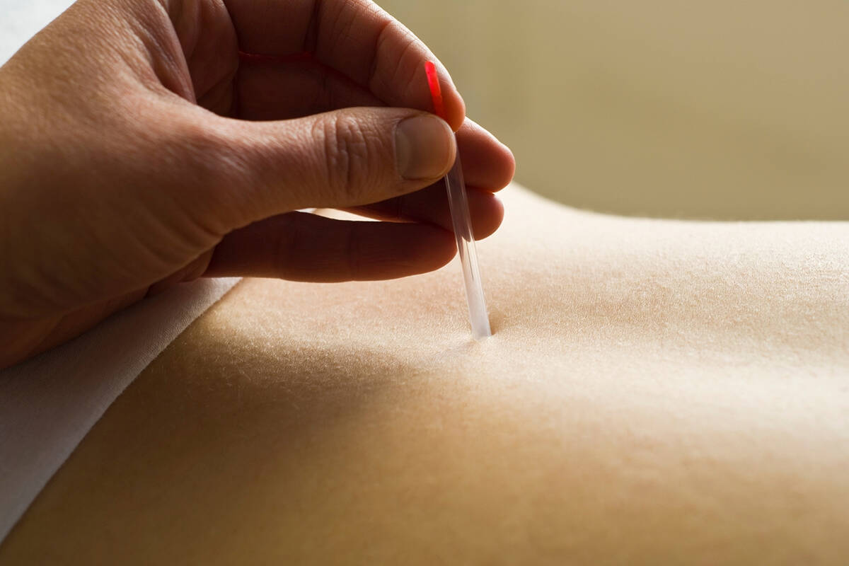 都会で宿泊しながら、心身を整える！アーバン・リトリート ～キタノ×ウチイケ鍼灸整体院 ウェルネス宿泊プランはいかが？