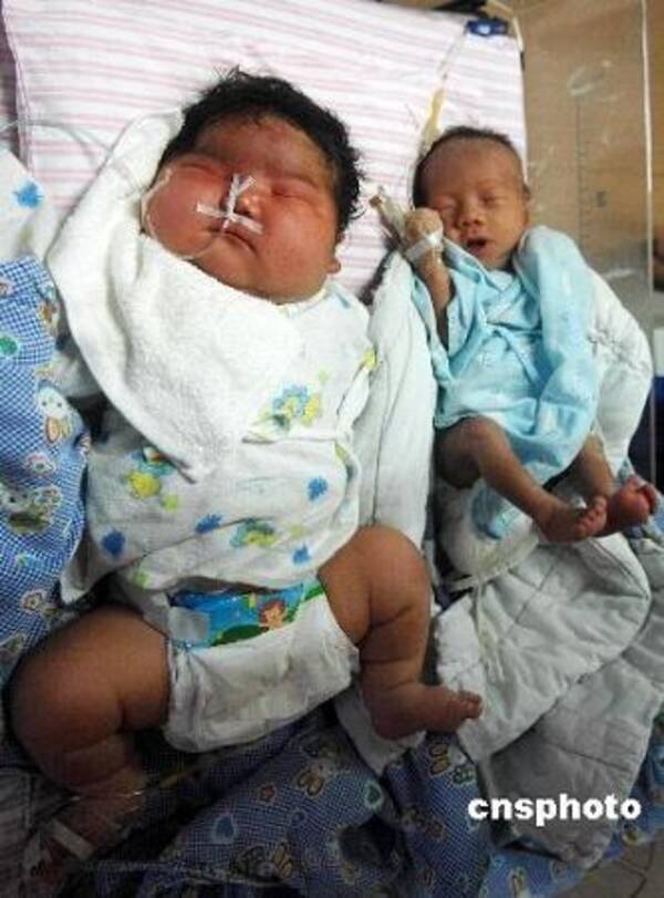 6 4キロ 中国で一番大きい赤ちゃん 誕生 08年11月6日 エキサイトニュース
