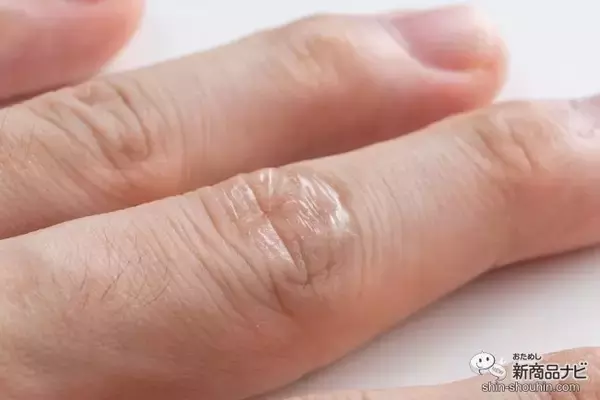 「絆創膏がはがれやすい箇所でも傷を保護できる！ 『ウォーターエイド』（指定医薬部外品）でストレス軽減！」の画像