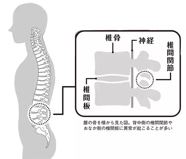 日本人の4人にひとりが悩んでる！　意外と知らない"腰痛"の基礎知識＆お悩み相談