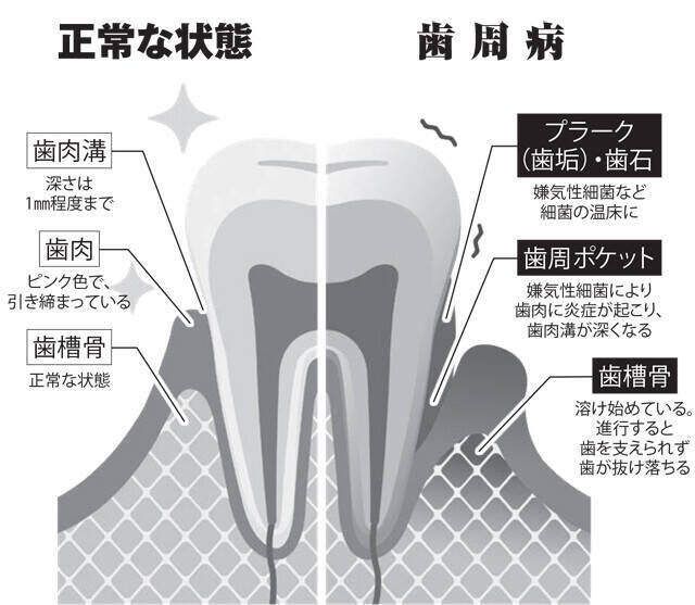 日本は「歯が汚い国」ってマジですか！？「歯科健診義務化」の謎を追う！