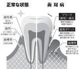 「日本は「歯が汚い国」ってマジですか！？「歯科健診義務化」の謎を追う！」の画像3