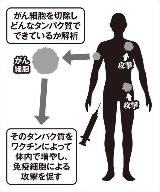 「mRNAがんワクチン」は夢の薬になるのか？