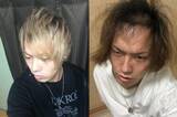 「20代前半のころ「薄毛を隠していた」男性が、“隠さなくなってから”気づいたこと――仰天ニュース特報」の画像1