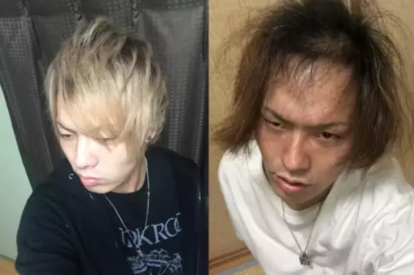 20代前半のころ「薄毛を隠していた」男性が、“隠さなくなってから”気づいたこと――仰天ニュース特報