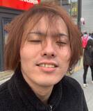 「20代前半のころ「薄毛を隠していた」男性が、“隠さなくなってから”気づいたこと――仰天ニュース特報」の画像3