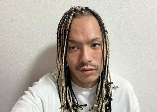 20代前半のころ「薄毛を隠していた」男性が、“隠さなくなってから”気づいたこと――仰天ニュース特報