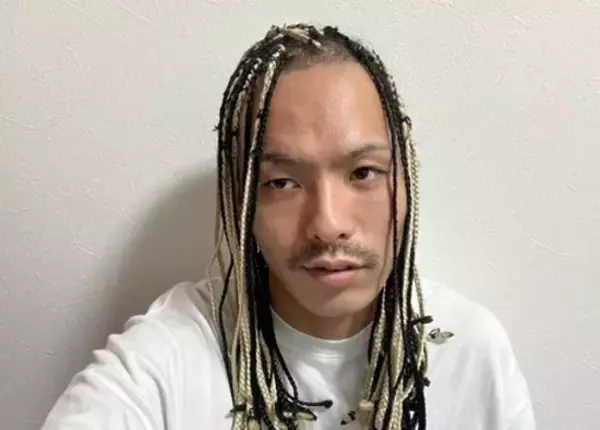 「20代前半のころ「薄毛を隠していた」男性が、“隠さなくなってから”気づいたこと――仰天ニュース特報」の画像