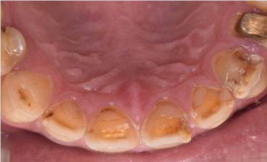 “唾液力”の低下が地味な不調の原因に。歯科医が指摘する3つの悪習慣