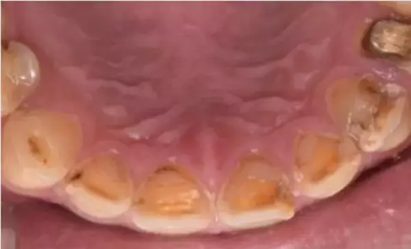 「“唾液力”の低下が地味な不調の原因に。歯科医が指摘する3つの悪習慣」の画像