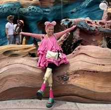 「両手足を切断しました」40歳女性を襲った病「最初は胃腸炎と診断されて…」10日間意識不明に――年末年始ベスト