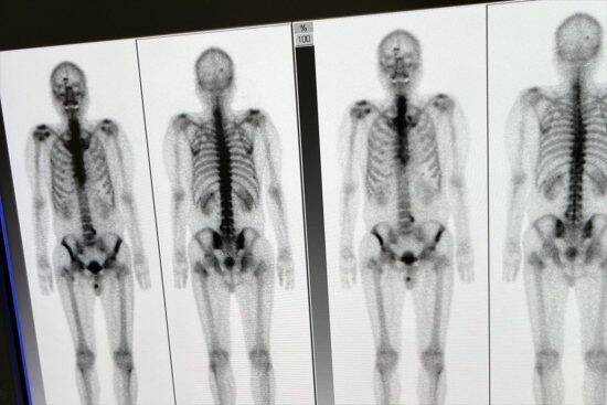 ステージ4のがん宣告で60代男性が選んだ道。タイで療養生活を始めたワケ「好きな酒を飲みながら穏やかに過ごす」