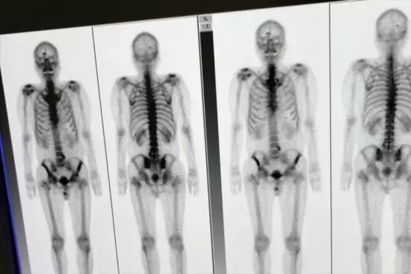 「ステージ4のがん宣告で60代男性が選んだ道。タイで療養生活を始めたワケ「好きな酒を飲みながら穏やかに過ごす」」の画像