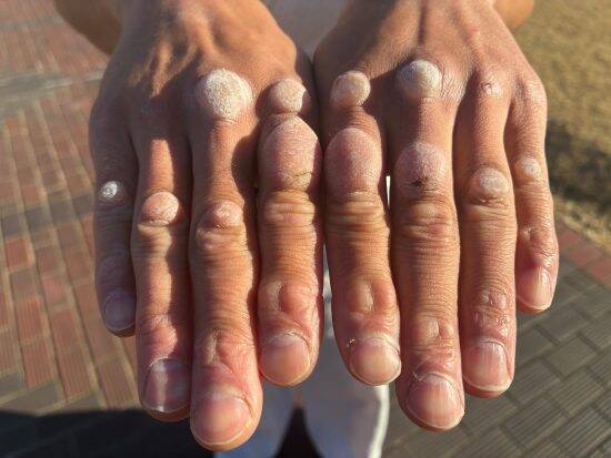 “最強の拳”は意外とぷにぷに…拳を毎日アスファルトに叩きつける34歳男の素顔「仕事で会う人全員に(拳を)二度見される」