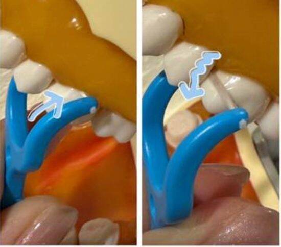 歯医者が断言！“フロス・歯間ブラシをしない人”が10年後に後悔するワケ