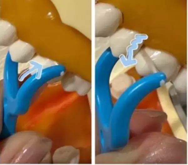 「歯医者が断言！“フロス・歯間ブラシをしない人”が10年後に後悔するワケ」の画像