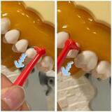 「歯医者が断言！“フロス・歯間ブラシをしない人”が10年後に後悔するワケ」の画像6