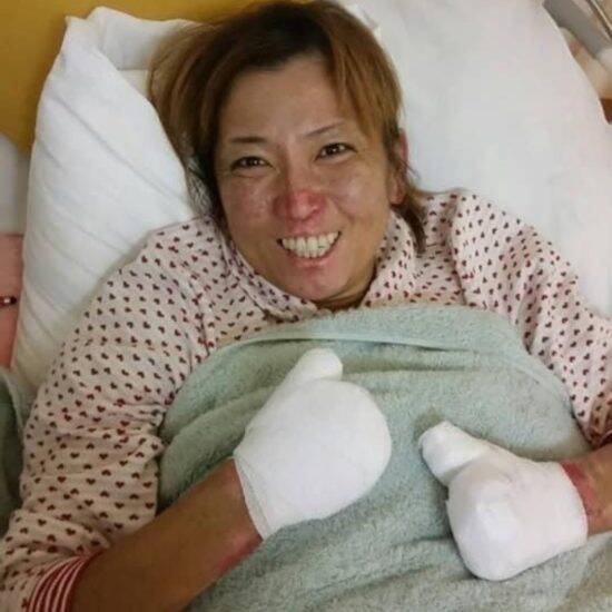 「両手足を切断しました」40歳女性を襲った病「最初は胃腸炎と診断されて…」10日間意識不明に＜GW限定スペシャル＞