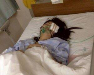 「割れたグラスが刺さり…」19歳で片目を失明した女性を直撃。義眼20万円も全額自費…制度の狭間で苦しむ人々のリアル