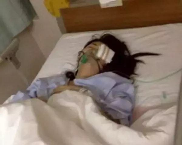 「「割れたグラスが刺さり…」19歳で片目を失明した女性を直撃。義眼20万円も全額自費…制度の狭間で苦しむ人々のリアル」の画像