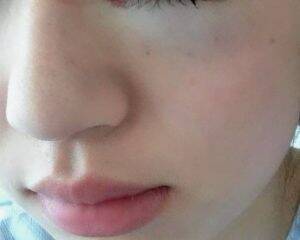 「割れたグラスが刺さり…」19歳で片目を失明した女性を直撃。義眼20万円も全額自費…制度の狭間で苦しむ人々のリアル