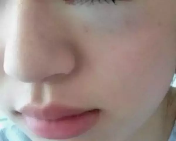 「「割れたグラスが刺さり…」19歳で片目を失明した女性を直撃。義眼20万円も全額自費…制度の狭間で苦しむ人々のリアル」の画像