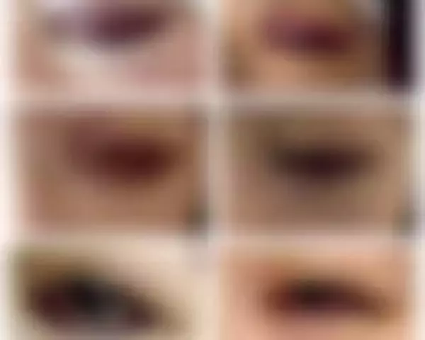 「「割れたグラスが刺さり…」19歳で片目を失明した女性を直撃。義眼20万円も全額自費…制度の狭間で苦しむ人々のリアル」の画像