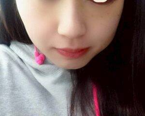 「割れたグラスが刺さり…」19歳で片目を失明した女性を直撃。義眼20万円も全額自費…制度の狭間で苦しむ人々のリアル