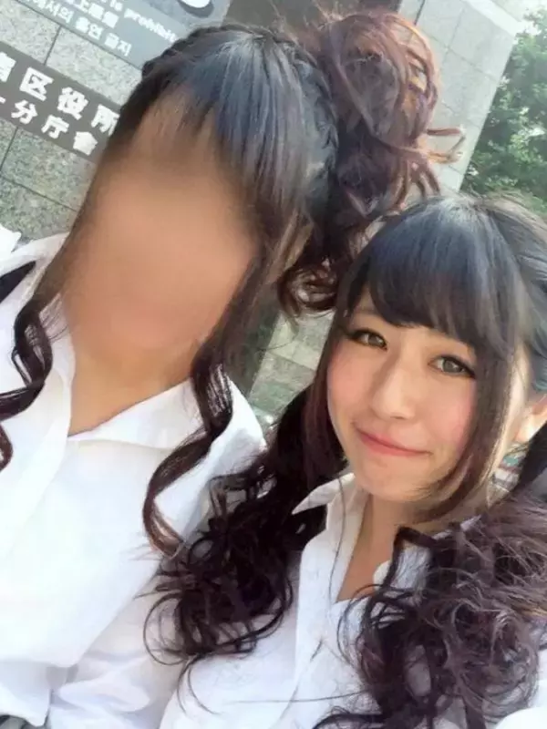 「「割れたグラスが刺さり…」19歳で片目を失明した女性を直撃。義眼20万円も全額自費…制度の狭間で苦しむ人々のリアル」の画像