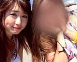 「「割れたグラスが刺さり…」19歳で片目を失明した女性を直撃。義眼20万円も全額自費…制度の狭間で苦しむ人々のリアル」の画像4