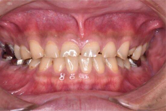 正月明け、鏡を見て「老けたかも？」歯科医師が教える“口内老け”リセット術