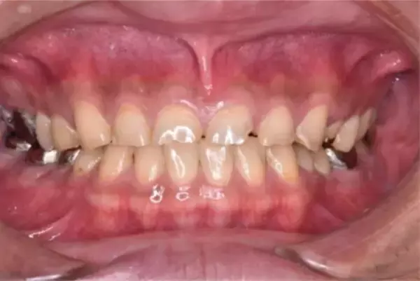 「正月明け、鏡を見て「老けたかも？」歯科医師が教える“口内老け”リセット術」の画像