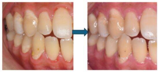 正月明け、鏡を見て「老けたかも？」歯科医師が教える“口内老け”リセット術