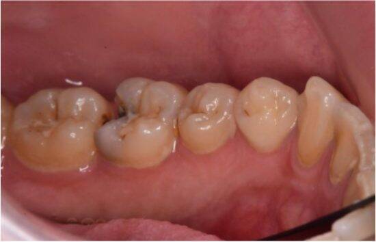 正月明け、鏡を見て「老けたかも？」歯科医師が教える“口内老け”リセット術