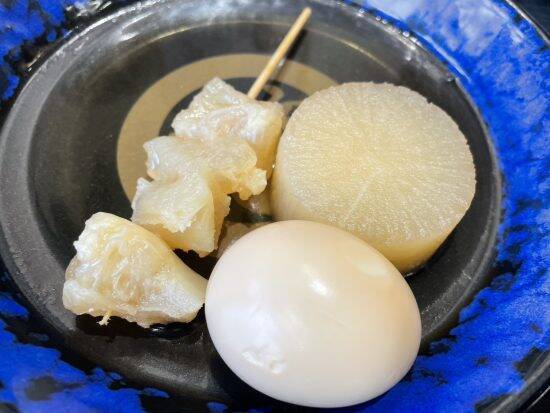 「この数値でまだ食うのか」医師に止められた32歳、γ-GT60倍でも資さんうどんで“2000円分の炭水化物”を止められない理由