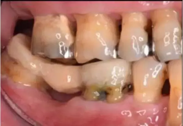 「「急に老けた」「疲れて見える」は口の中から始まる。“唾液力”が落ちてしまう悪習慣」の画像