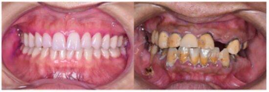 「急に老けた」「疲れて見える」は口の中から始まる。“唾液力”が落ちてしまう悪習慣