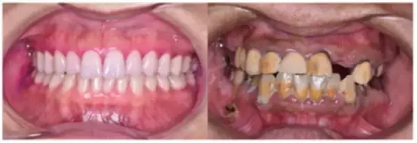 「「急に老けた」「疲れて見える」は口の中から始まる。“唾液力”が落ちてしまう悪習慣」の画像