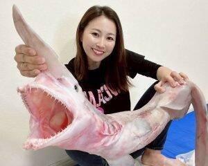 高3で、突然「あいうえお」が発声できなくなった…「喉に金属を埋める手術」を受けた34歳女性が“救い”を見つけるまで