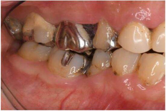 妻が密かに怯えている“夫の口臭問題”。歯科医が教えるオーラルケア4か条