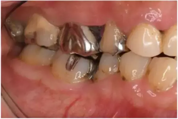 「妻が密かに怯えている“夫の口臭問題”。歯科医が教えるオーラルケア4か条」の画像